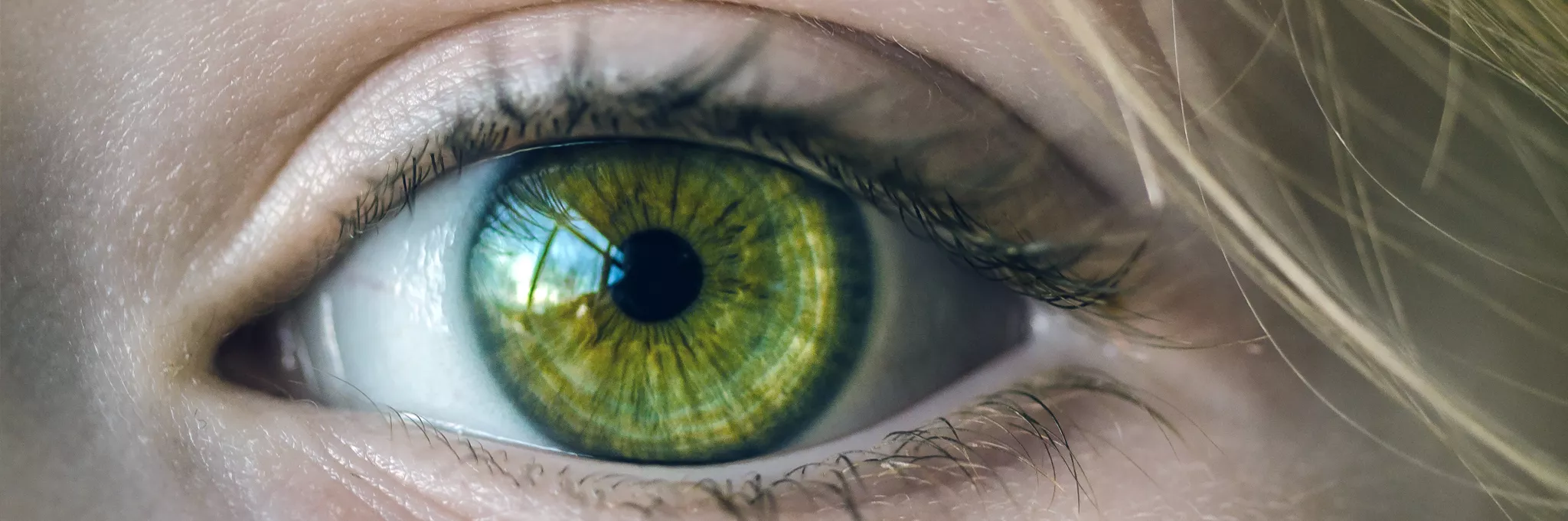 Iridology, The Healer Centre, Hassocks, Sussex