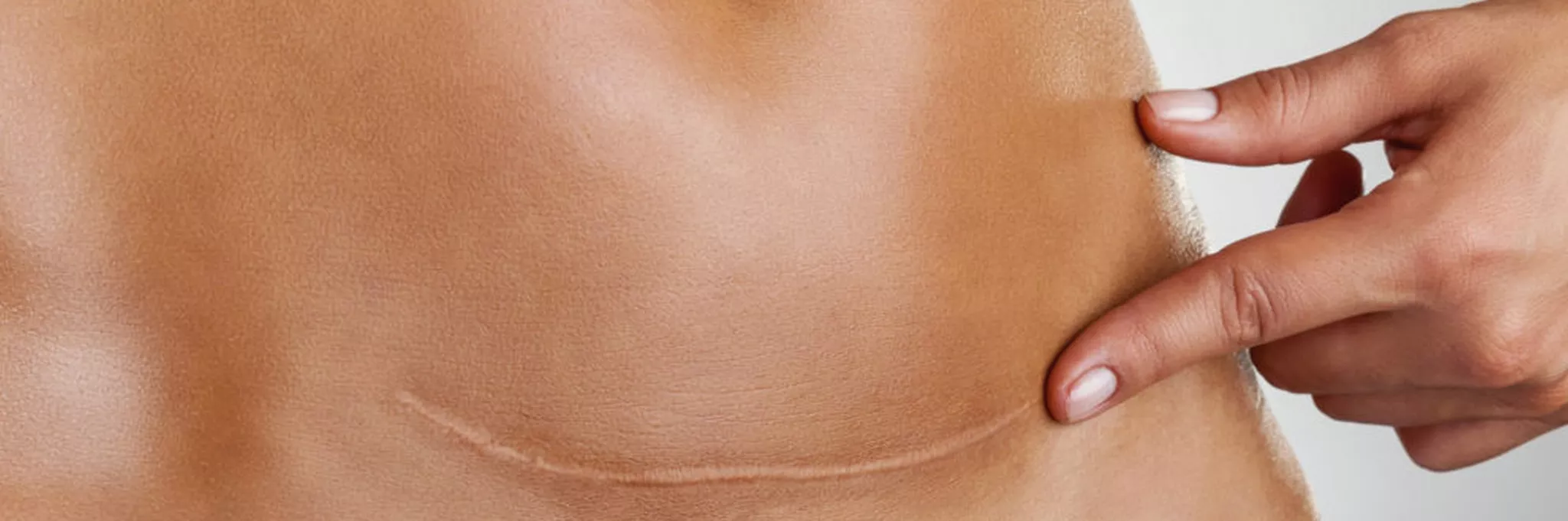 Scar Therapy & Fascial Release at The Heeler Centre Hassocks